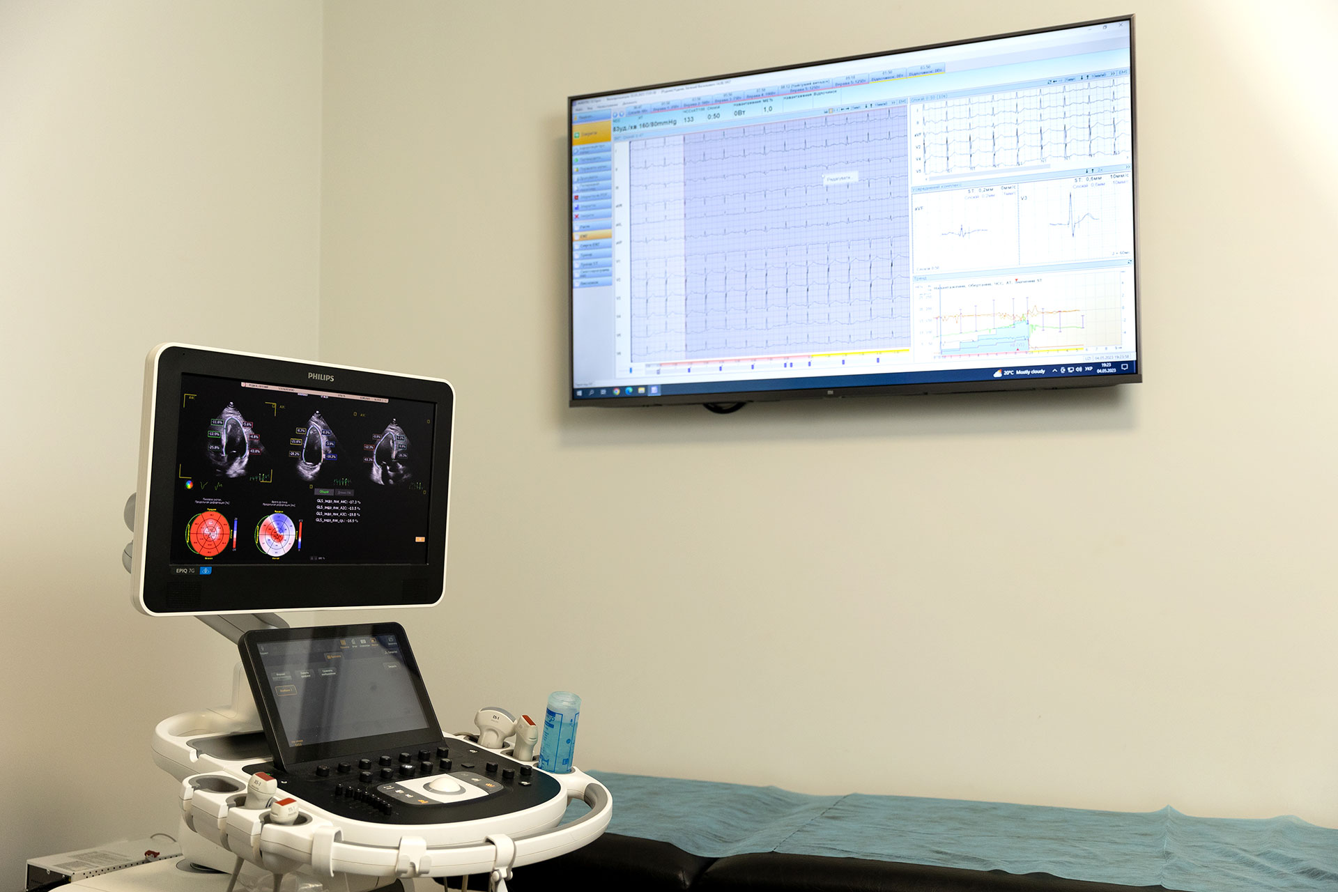 ЕХОкардіографія зі Speckl tracking Alcor Clinic